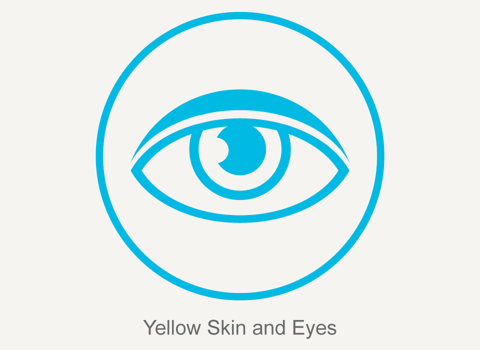 Common symptoms: Yellow Skin and Eyes, Hepatitis C, Ashray Mylan