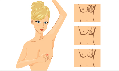 Self-examination, Step 2: Stretch arms over the head and examine breasts