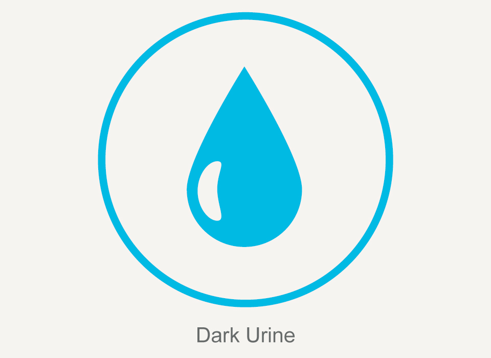 Common symptoms: Dark Urine, Hepatitis C, Ashray Mylan